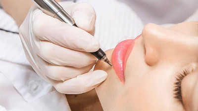 Sebelum Mencoba Sulam Bibir, Ketahui 4 Efek Samping Ini